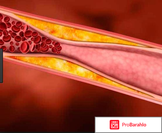 Розувастатин канон инструкция по применению цена обман