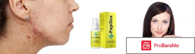 Papillox отзывы владельцев