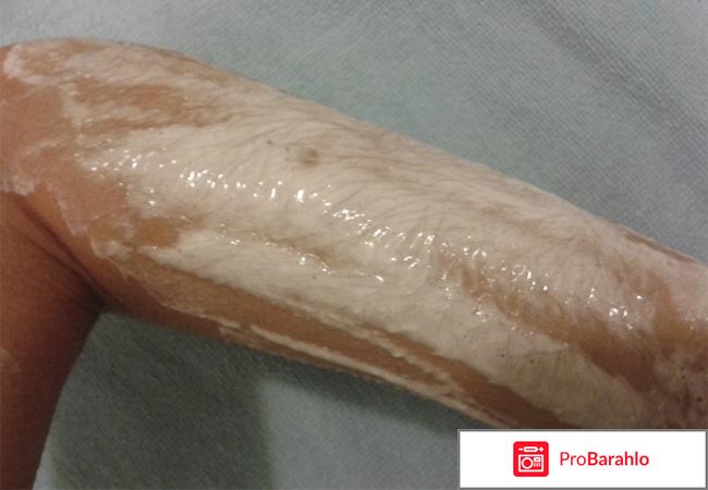 Осветление волос на руках в домашних условиях отрицательные отзывы