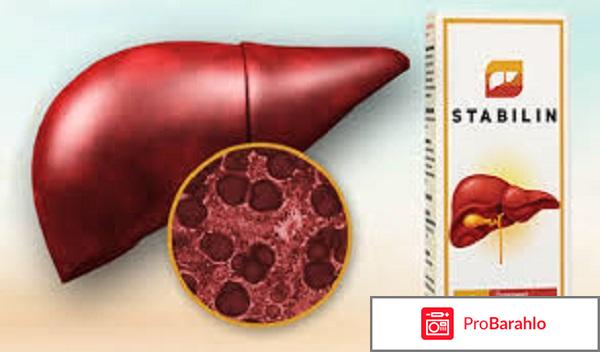 STABILIN для печени — Цена, состав и отзывы врачей. 