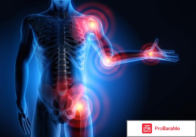 Артра отзывы отрицательные отзывы