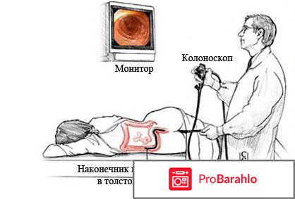 Колоноскопия - Колоноскопия под наркозом 