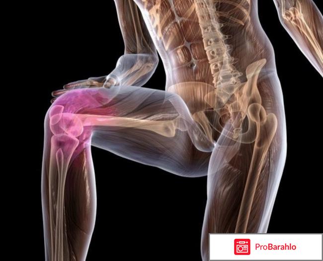 Сустафаст для лечения суставов фото