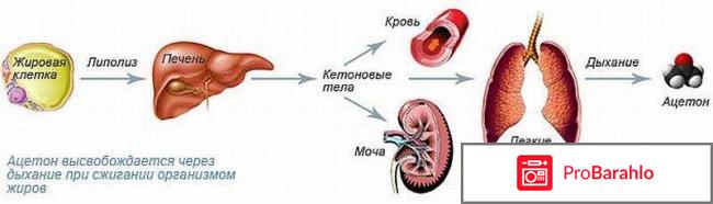 Запах ацетона изо рта у ребенка причины 