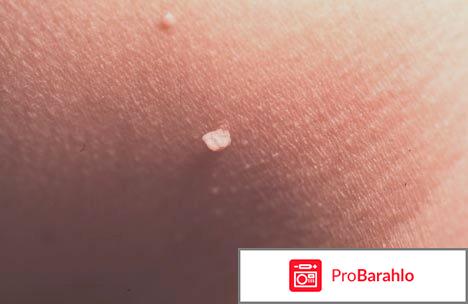 Intoxic реальные отзывы 