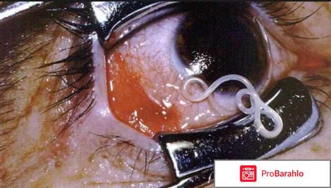 Unitox развод или правда 