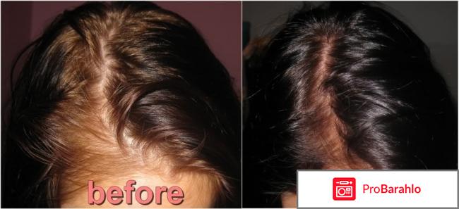 HoneyTeddyHair - витамины для волос 