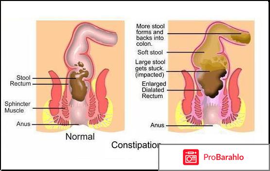 Капли огаркова отрицательные отзывы