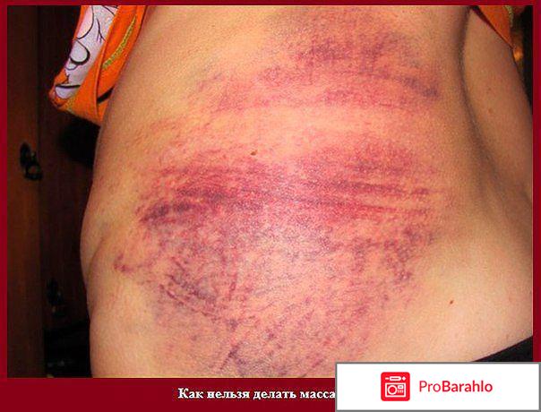 Массаж для похудения отзывы 