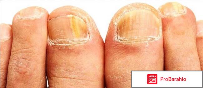 Тинедолин отзывы обман