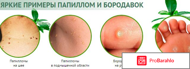 Папиловит (Papilovit) отрицательные отзывы