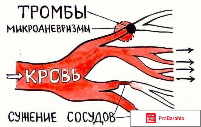 Венза обман