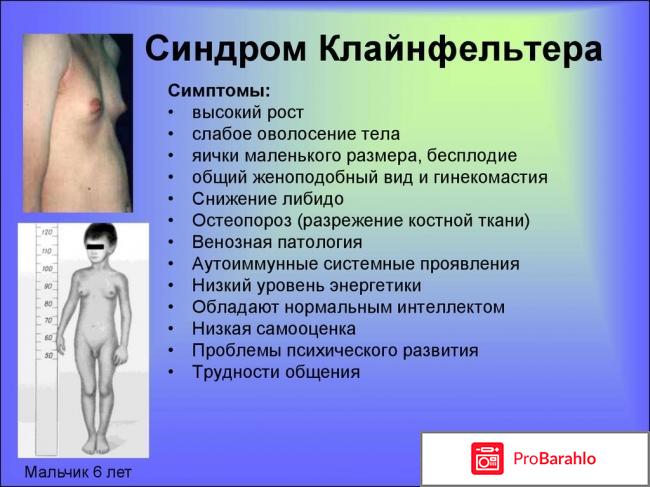 СИНДРОМ КЛАЙНФЕЛЬТЕРА - взгляните на своих мужчин отрицательные отзывы