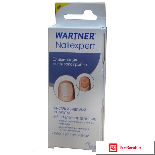 Nailexpert by wartner 