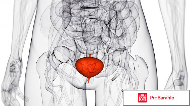 Геморрагический цистит у женщин симптомы и лечение отрицательные отзывы