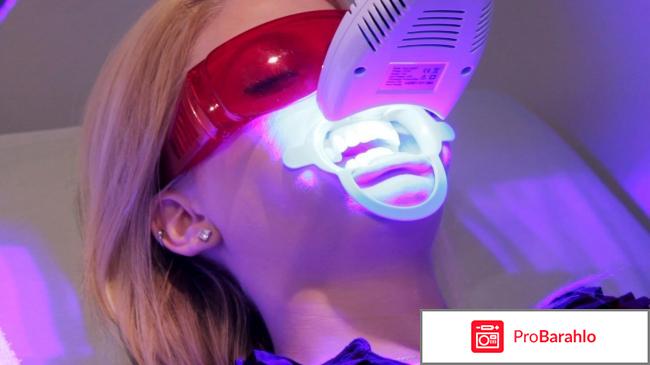 Фотоотбеливание зубов 