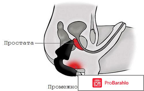 Массажер простаты отзывы врачей 