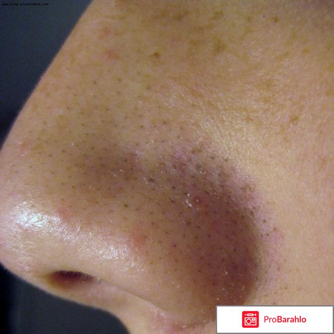 Черные точки обман