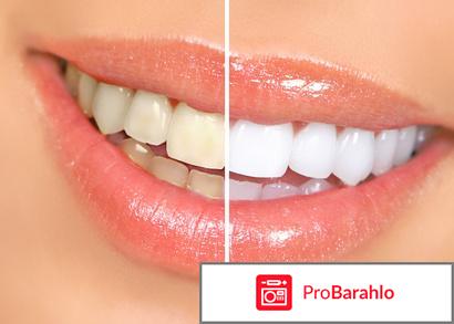 Отбеливание зубов ZOOM 3 