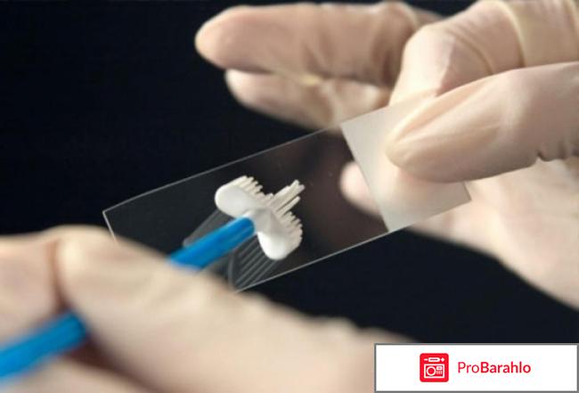 Пайпель биопсия эндометрия обман