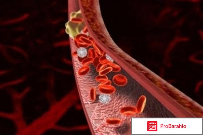 Тромбоасс отрицательные отзывы