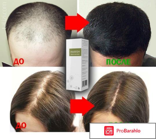 Hairish для роста волос, Хэириш - развод или нет? отрицательные отзывы