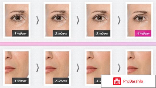 Bonatox отзывы отрицательные отрицательные отзывы