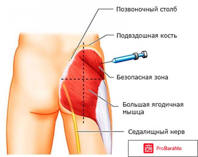 Боль в копчике отрицательные отзывы