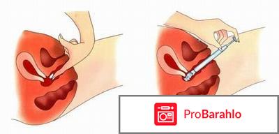 Фарматекс таблетки отзывы обман
