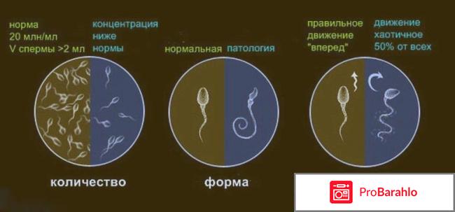 Азооспермия лечение отзывы у мужчин отрицательные отзывы