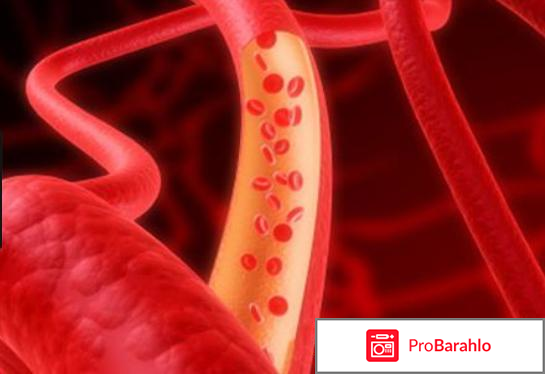 Лозап отзывы врачей кардиологов обман