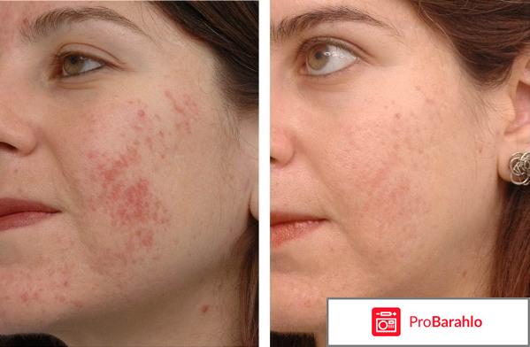 Цинктерал отзывы для волос для женщин отрицательные отзывы