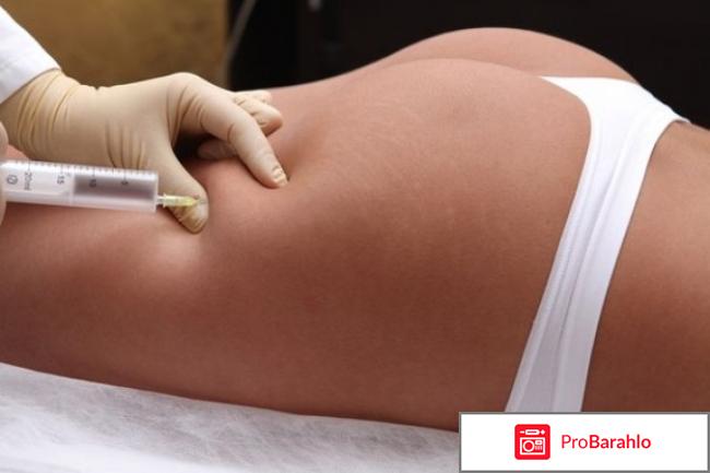 Липолитики для похудения фото обман