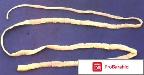 Свиной цепень вызывает заболевание обман