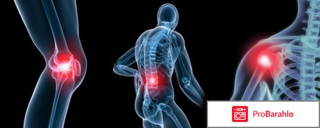 Артодекс отрицательные отзывы