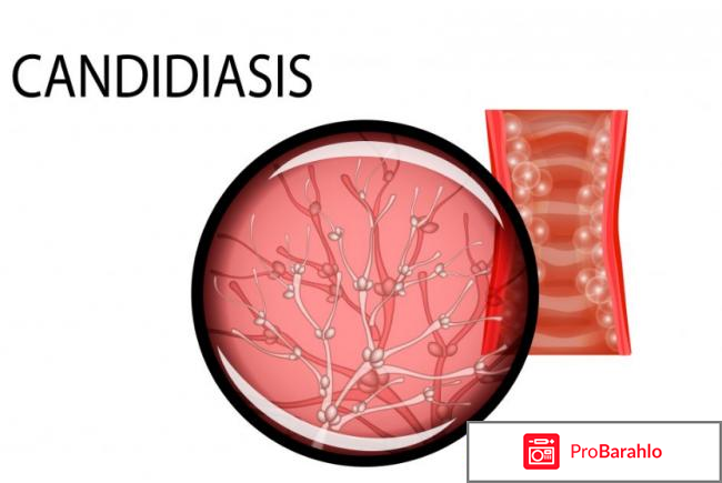 Лучшее лекарство от молочницы у женщин отзывы 