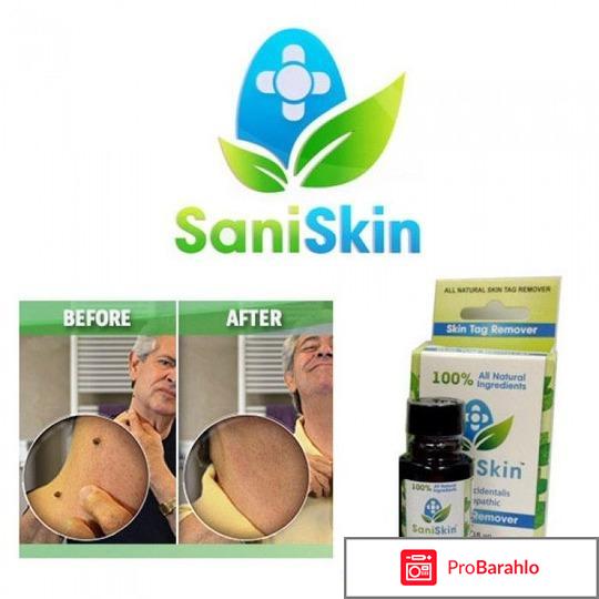 Сани скин от папиллом отзывы покупателей обман