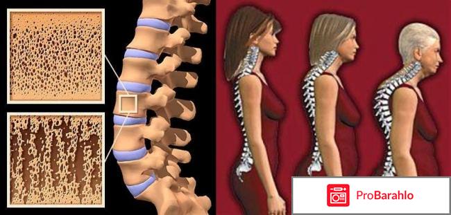 Тевабон отрицательные отзывы