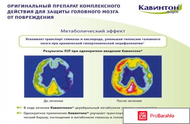 Кавинтон комфорте отзывы пациентов людей принимающих отрицательные отзывы