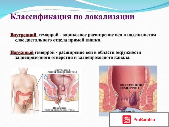Unigem отрицательные отзывы