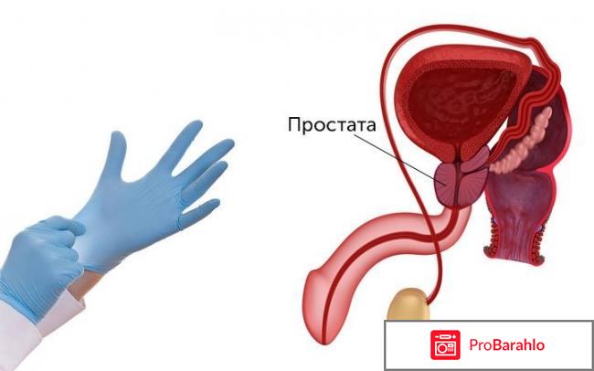 Predstavit отзывы отрицательные отрицательные отзывы