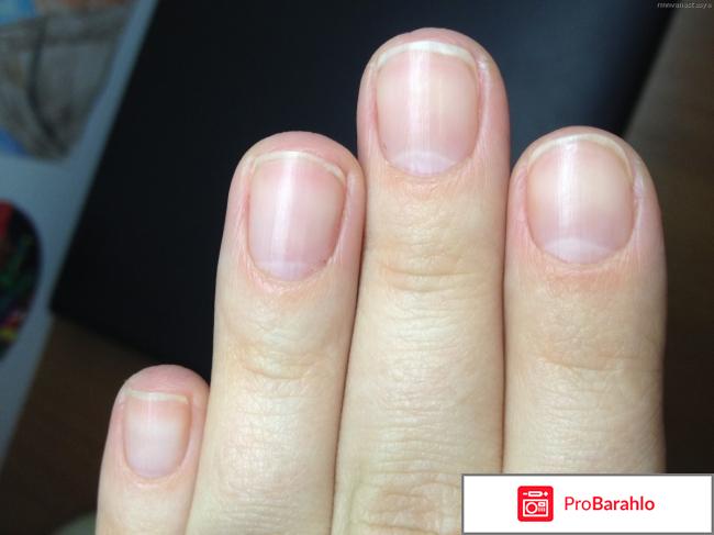 Деакура фото