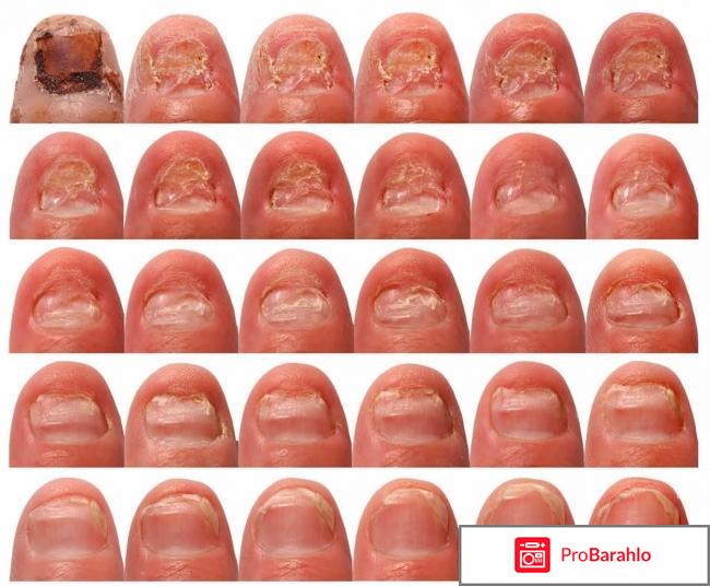 Фламин лак цена обман