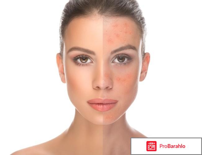 Нано ботокс крем отзывы отрицательные отзывы