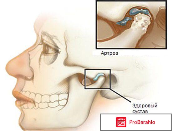 Мрт нижней челюсти отрицательные отзывы