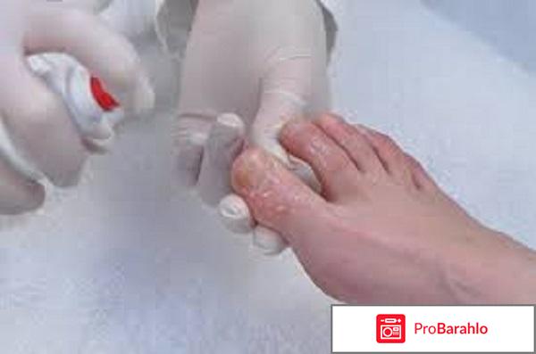 Экзодерил при беременности 