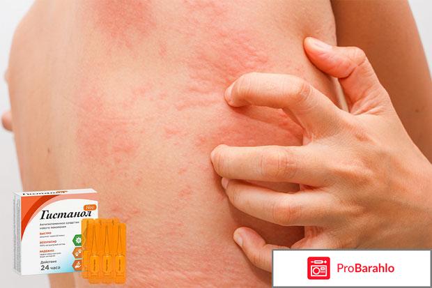 Гистанол Нео обман