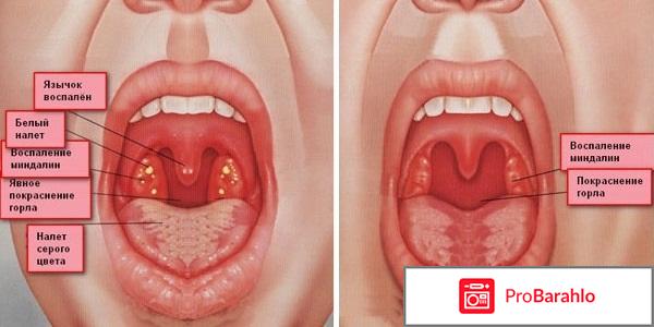 Хлорфилипт обман