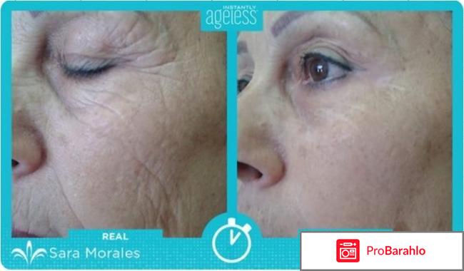 Ageless Instantly: отзывы про крем от морщин Инстантли обман