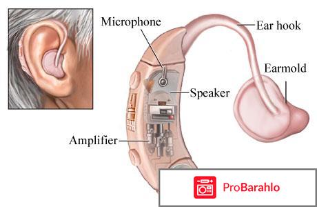 Слуховые аппараты для пожилых людей отзывы форум 
